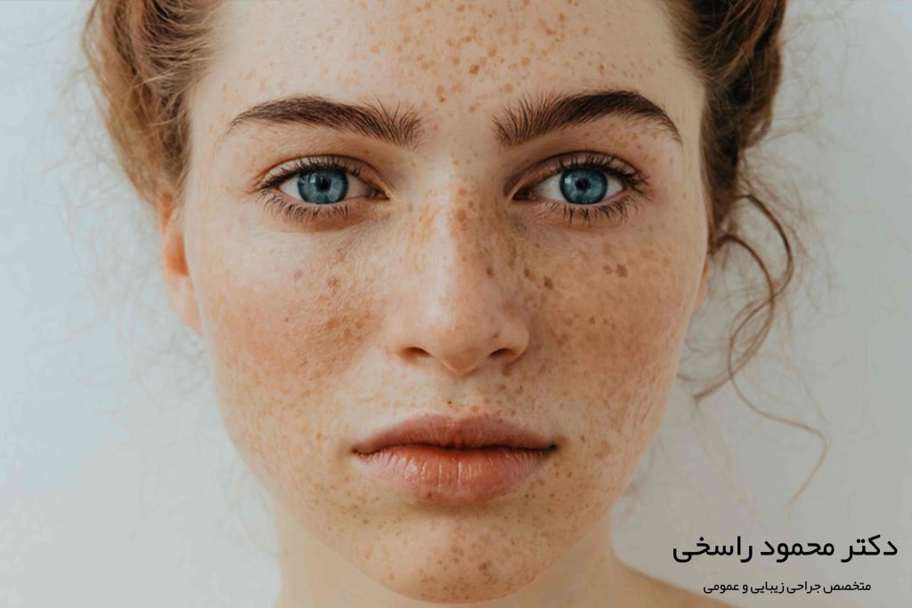 خال