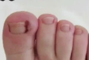 ناخن