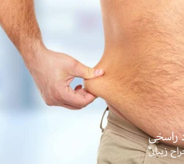 هزینه عمل لیپوساکشن شکم