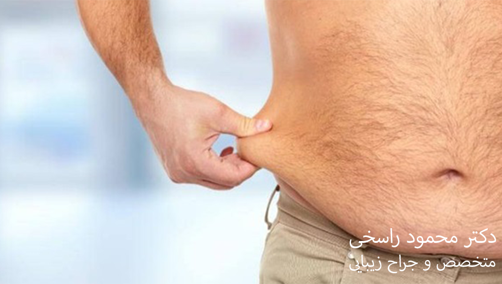 هزینه عمل لیپوساکشن شکم